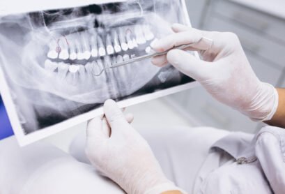 endodoncia-nota
