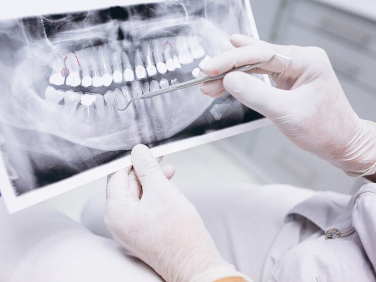endodoncia-nota
